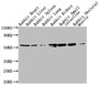 Western Blot, Positive WB detected in: Rabbit heatrt tissue, Rabbit liver tissue, Rabbit spleen tissue, Rabbit lung tissue, Rabbit kidney tissue, Rabbit small intestine tissue, Rabbit skeletal muscle tissue, All lanes: TUBA1A antibody at 1:5000, Secondary, Goat polyclonal to Mouse IgG at 1/10000 dilution, Predicted band size: 52 kDa, Observed band size: 52 kDa Western Blot, Positive WB detected in: Rabbit heatrt tissue, Rabbit liver tissue, Rabbit spleen tissue, Rabbit lung tissue, Rabbit kidney tissue, Rabbit small intestine tissue, Rabbit skeletal muscle tissue, All lanes: TUBA1A antibody at 1:5000, Secondary, Goat polyclonal to Mouse IgG at 1/10000 dilution, Predicted band size: 52 kDa, Observed band size: 52 kDa