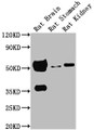 Western Blot, Positive WB detected in: Rat brain tissue, Rat stomach tissue, Rat kidney tissue, All lanes: TUBA1A antibody at 1:5000, Secondary, Goat polyclonal to Mouse IgG at 1/10000 dilution, Predicted band size: 52 kDa, Observed band size: 52 kDa Western Blot, Positive WB detected in: Rat brain tissue, Rat stomach tissue, Rat kidney tissue, All lanes: TUBA1A antibody at 1:5000, Secondary, Goat polyclonal to Mouse IgG at 1/10000 dilution, Predicted band size: 52 kDa, Observed band size: 52 kDa