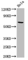 Western Blot, Positive WB detected in: Hela whole cell lysate, All lanes: ACADVL antibody at 2ug/ml, Secondary, Goat polyclonal to rabbit IgG at 1/50000 dilution, Predicted band size: 71, 69, 73 kDa, Observed band size: 71 kDa Western Blot, Positive WB detected in: Hela whole cell lysate, All lanes: ACADVL antibody at 2ug/ml, Secondary, Goat polyclonal to rabbit IgG at 1/50000 dilution, Predicted band size: 71, 69, 73 kDa, Observed band size: 71 kDa