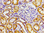 Immunohistochemistry of paraffin-embedded human kidney tissue using CAC12985 at dilution of 1:100 Immunohistochemistry of paraffin-embedded human kidney tissue using CAC12985 at dilution of 1:100