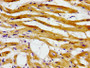 Immunohistochemistry of paraffin-embedded human heart tissue using CAC12985 at dilution of 1:100 Immunohistochemistry of paraffin-embedded human heart tissue using CAC12985 at dilution of 1:100