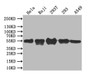 Western Blot, Positive WB detected in: Mouse heart tissue, All lanes: BCL3 antibody at 3.2ug/ml, Secondary, Goat polyclonal to rabbit IgG at 1/50000 dilution, Predicted band size: 48 kDa, Observed band size: 60 kDa Western Blot, Positive WB detected in: Mouse heart tissue, All lanes: BCL3 antibody at 3.2ug/ml, Secondary, Goat polyclonal to rabbit IgG at 1/50000 dilution, Predicted band size: 48 kDa, Observed band size: 60 kDa