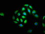Immunofluorescence staining of A549 cells with CAC12993 at 1:133, counter-stained with DAPI. The cells were fixed in 4% formaldehyde, permeabilized using 0.2% Triton X-100 and blocked in 10% normal Goat Serum. The cells were then incubated with the antibody overnight at 4°C. The secondary antibody was Alexa Fluor 488-congugated AffiniPure Goat Anti-Rabbit IgG(H+L). Immunofluorescence staining of A549 cells with CAC12993 at 1:133, counter-stained with DAPI. The cells were fixed in 4% formaldehyde, permeabilized using 0.2% Triton X-100 and blocked in 10% normal Goat Serum. The cells were then incubated with the antibody overnight at 4°C. The secondary antibody was Alexa Fluor 488-congugated AffiniPure Goat Anti-Rabbit IgG(H+L).