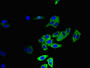Immunofluorescent analysis of HepG2 cells using CAC13001 at dilution of 1:100 and Alexa Fluor 488-congugated AffiniPure Goat Anti-Rabbit IgG(H+L) Immunofluorescent analysis of HepG2 cells using CAC13001 at dilution of 1:100 and Alexa Fluor 488-congugated AffiniPure Goat Anti-Rabbit IgG(H+L)