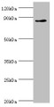 Western Blot, All lanes: CDH11 antibody at 6ug/ml + Jurkat whole cell lysate, Secondary, Goat polyclonal to rabbit IgG at 1/10000 dilution, Predicted band size: 88, 77 kDa, Observed band size: 88 kDa Western Blot, All lanes: CDH11 antibody at 6ug/ml + Jurkat whole cell lysate, Secondary, Goat polyclonal to rabbit IgG at 1/10000 dilution, Predicted band size: 88, 77 kDa, Observed band size: 88 kDa
