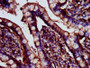 IHC image of CAC13009 diluted at 1:200 and staining in paraffin-embedded human small intestine tissue performed on a Leica BondTM system. After dewaxing and hydration, antigen retrieval was mediated by high pressure in a citrate buffer (pH 6.0). Section was blocked with 10% normal goat serum 30min at RT. Then primary antibody (1% BSA) was incubated at 4°C overnight. The primary is detected by a biotinylated secondary antibody and visualized using an HRP conjugated SP system. IHC image of CAC13009 diluted at 1:200 and staining in paraffin-embedded human small intestine tissue performed on a Leica BondTM system. After dewaxing and hydration, antigen retrieval was mediated by high pressure in a citrate buffer (pH 6.0). Section was blocked with 10% normal goat serum 30min at RT. Then primary antibody (1% BSA) was incubated at 4°C overnight. The primary is detected by a biotinylated secondary antibody and visualized using an HRP conjugated SP system.