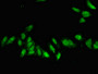 Immunofluorescent analysis of Hela cells using CAC13010 at dilution of 1:100 and Alexa Fluor 488-congugated AffiniPure Goat Anti-Rabbit IgG(H+L) Immunofluorescent analysis of Hela cells using CAC13010 at dilution of 1:100 and Alexa Fluor 488-congugated AffiniPure Goat Anti-Rabbit IgG(H+L)