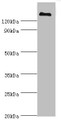 Western Blot, All lanes: CFH antibody at 3ug/ml + human serum, Secondary, Goat polyclonal to rabbit IgG at 1/10000 dilution, Predicted band size: 140, 52 kDa, Observed band size: 140 kDa Western Blot, All lanes: CFH antibody at 3ug/ml + human serum, Secondary, Goat polyclonal to rabbit IgG at 1/10000 dilution, Predicted band size: 140, 52 kDa, Observed band size: 140 kDa