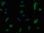 Immunofluorescence staining of U251 cells with CAC13013 at 1:50,counter-stained with DAPI. The cells were fixed in 4% formaldehyde, permeabilized using 0.2% Triton X-100 and blocked in 10% normal Goat Serum. The cells were then incubated with the antibody overnight at 4°C.The secondary antibody was Alexa Fluor 488-congugated AffiniPure Goat Anti-Rabbit IgG (H+L). Immunofluorescence staining of U251 cells with CAC13013 at 1:50,counter-stained with DAPI. The cells were fixed in 4% formaldehyde, permeabilized using 0.2% Triton X-100 and blocked in 10% normal Goat Serum. The cells were then incubated with the antibody overnight at 4°C.The secondary antibody was Alexa Fluor 488-congugated AffiniPure Goat Anti-Rabbit IgG (H+L).