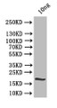 Western Blot, Positive WB detected in: recombinant protein, All lanes:clsA Antibody at 1:1000, Secondary, Goat polyclonal to rabbit IgG at 1/50000 dilution, Predicted band size: 21.8 kDa, Observed band size: 22 kDa Western Blot, Positive WB detected in: recombinant protein, All lanes:clsA Antibody at 1:1000, Secondary, Goat polyclonal to rabbit IgG at 1/50000 dilution, Predicted band size: 21.8 kDa, Observed band size: 22 kDa