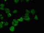 Immunofluorescent analysis of HepG2 cells using CAC13018 at dilution of 1:100 and Alexa Fluor 488-congugated AffiniPure Goat Anti-Rabbit IgG(H+L) Immunofluorescent analysis of HepG2 cells using CAC13018 at dilution of 1:100 and Alexa Fluor 488-congugated AffiniPure Goat Anti-Rabbit IgG(H+L)