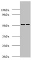 Western Blot, All lanes: AP-2 complex subunit mu polyclonal Antibody at 2ug/ml, Lane 1: Mouse brain tissue, Lane 2: Rat brain tissue, Secondary, Goat polyclonal to rabbit IgG at 1/10000 dilution, Predicted band size: 50 kDa, Observed band size: 50 kDa Western Blot, All lanes: AP-2 complex subunit mu polyclonal Antibody at 2ug/ml, Lane 1: Mouse brain tissue, Lane 2: Rat brain tissue, Secondary, Goat polyclonal to rabbit IgG at 1/10000 dilution, Predicted band size: 50 kDa, Observed band size: 50 kDa