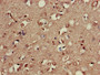 Immunohistochemistry of paraffin-embedded human brain tissue using CAC13020 at dilution of 1:100 Immunohistochemistry of paraffin-embedded human brain tissue using CAC13020 at dilution of 1:100