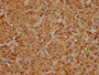 IHC image of CAC13022 diluted at 1:100 and staining in paraffin-embedded human adrenal gland tissue performed on a Leica BondTM system. After dewaxing and hydration, antigen retrieval was mediated by high pressure in a citrate buffer (pH 6.0). Section was blocked with 10% normal goat serum 30min at RT. Then primary antibody (1% BSA) was incubated at 4°C overnight. The primary is detected by a biotinylated secondary antibody and visualized using an HRP conjugated SP system. IHC image of CAC13022 diluted at 1:100 and staining in paraffin-embedded human adrenal gland tissue performed on a Leica BondTM system. After dewaxing and hydration, antigen retrieval was mediated by high pressure in a citrate buffer (pH 6.0). Section was blocked with 10% normal goat serum 30min at RT. Then primary antibody (1% BSA) was incubated at 4°C overnight. The primary is detected by a biotinylated secondary antibody and visualized using an HRP conjugated SP system.