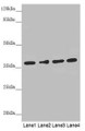 Western Blot, All lanes: ERLIN2 antibody at 3.1ug/ml, Lane 1: 293T whole cell lysate, Lane 2: HepG2 whole cell lysate, Lane 3: U251 whole cell lysate, Lane 4: Hela whole cell lysate, Secondary, Goat polyclonal to rabbit IgG at 1/10000 dilution, Predicted band size: 38, 17, 23 kDa, Observed band size: 38 kDa Western Blot, All lanes: ERLIN2 antibody at 3.1ug/ml, Lane 1: 293T whole cell lysate, Lane 2: HepG2 whole cell lysate, Lane 3: U251 whole cell lysate, Lane 4: Hela whole cell lysate, Secondary, Goat polyclonal to rabbit IgG at 1/10000 dilution, Predicted band size: 38, 17, 23 kDa, Observed band size: 38 kDa