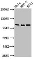 Western Blot, Positive WB detected in: Hela whole cell lysate, MCF-7 whole cell lysate, K562 whole cell lysate, All lanes: EVC antibody at 2ug/ml, Secondary, Goat polyclonal to rabbit IgG at 1/50000 dilution, Predicted band size: 112 kDa, Observed band size: 112 kDa Western Blot, Positive WB detected in: Hela whole cell lysate, MCF-7 whole cell lysate, K562 whole cell lysate, All lanes: EVC antibody at 2ug/ml, Secondary, Goat polyclonal to rabbit IgG at 1/50000 dilution, Predicted band size: 112 kDa, Observed band size: 112 kDa
