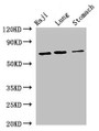 Western Blot, Positive WB detected in: Raji whole cell lysate, Mouse lung tissue, Mouse stomach tissue, All lanes: FOXN1 antibody at 2.7ug/ml, Secondary, Goat polyclonal to rabbit IgG at 1/50000 dilution, Predicted band size: 69 kDa, Observed band size: 69 kDa