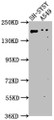Western Blot, Positive WB detected in: SH-SY5Y whole cell lysate, A549 whole cell lysate, All lanes: GLI2 antibody at 1:1000, Secondary, Goat polyclonal to rabbit IgG at 1/50000 dilution, Predicted band size: 168, 134, 132, 89, 87 kDa, Observed band size: 168 kDa