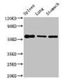 Western Blot, Positive WB detected in: Mouse spleen tissue, Mouse lung tissue, Mouse stomach tissue, All lanes: Glp1r antibody at 3ug/ml, Secondary, Goat polyclonal to rabbit IgG at 1/50000 dilution, Predicted band size: 54 kDa, Observed band size: 54 kDa