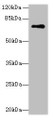 Western Blot, All lanes: GLS antibody at 5ug/ml + Mouse brain tissue, Secondary, Goat polyclonal to rabbit IgG at 1/10000 dilution, Predicted band size: 74, 18, 66 kDa, Observed band size: 74 kDa Western Blot, All lanes: GLS antibody at 5ug/ml + Mouse brain tissue, Secondary, Goat polyclonal to rabbit IgG at 1/10000 dilution, Predicted band size: 74, 18, 66 kDa, Observed band size: 74 kDa