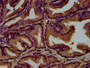 IHC image of CAC13048 diluted at 1:500 and staining in paraffin-embedded human prostate tissue performed on a Leica BondTM system. After dewaxing and hydration, antigen retrieval was mediated by high pressure in a citrate buffer (pH 6.0). Section was blocked with 10% normal goat serum 30min at RT. Then primary antibody (1% BSA) was incubated at 4°C overnight. The primary is detected by a biotinylated secondary antibody and visualized using an HRP conjugated SP system.