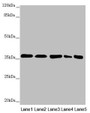 Western Blot, All lanes: GNB2 antibody at 2.22ug/ml, Lane 1: Mouse lung tissue, Lane 2: NIH/3T3 whole cell lysate, Lane 3: Jurkat whole cell lysate, Lane 4: 293T whole cell lysate, Lane 5: Hela whole cell lysate, Secondary, Goat polyclonal to rabbit IgG at 1/10000 dilution, Predicted band size: 38, 26 kDa, Observed band size: 38 kDa