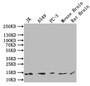 Western Blot, All lanes: H2AFJ antibody at 2ug/ml, Lane 1: Mouse brain tissue, Lane 2: MCF-7 whole cell lysate, Secondary, Goat polyclonal to rabbit IgG at 1/10000 dilution, Predicted band size: 15, 17 kDa, Observed band size: 15 kDa
