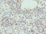 Immunohistochemistry of paraffin-embedded human bladder cancer using CAC13059 at dilution of 1:100