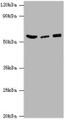 Western Blot, All lanes: HARS antibody at 6ug/ml, Lane 1: Hela whole cell lysate, Lane 2: K562 whole cell lysate, Lane 3: 293T whole cell lysate, Secondary, Goat polyclonal to rabbit IgG at 1/10000 dilution, Predicted band size: 58, 53, 51, 55 kDa, Observed band size: 58 kDa