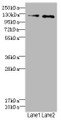 Western Blot, All lanes: HEPH antibody at 2.49ug/ml, Lane 1: HepG2 whole cell lysate, Lane 2: Jurkat whole cell lysate, Secondary, Goat polyclonal to rabbit IgG at 1/10000 dilution, Predicted band size: 131, 137, 101 kDa, Observed band size: 131 kDa