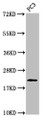 Western Blot, Positive WB detected in: PC-3 whole cell lysate, All lanes: HIST1H1D antibody at 1ug/ml, Secondary, Goat polyclonal to rabbit IgG at 1/50000 dilution, Predicted band size: 23 kDa, Observed band size: 23 kDa