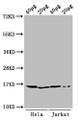 Western Blot, Positive WB detected in: Hela cell acid extracts, Jurkat cell acid extracts, All lanes: HIST1H3A antibody at 0.25ug/ml, Secondary, Goat polyclonal to rabbit IgG at 1/50000 dilution, Predicted band size: 16 kDa, Observed band size: 16 kDa Western Blot, Positive WB detected in: Hela cell acid extracts, Jurkat cell acid extracts, All lanes: HIST1H3A antibody at 0.25ug/ml, Secondary, Goat polyclonal to rabbit IgG at 1/50000 dilution, Predicted band size: 16 kDa, Observed band size: 16 kDa