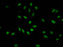 Immunofluorescent analysis of Hela cells using CAC13067 at dilution of 1:100 and Alexa Fluor 488-congugated AffiniPure Goat Anti-Rabbit IgG(H+L) Immunofluorescent analysis of Hela cells using CAC13067 at dilution of 1:100 and Alexa Fluor 488-congugated AffiniPure Goat Anti-Rabbit IgG(H+L)