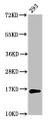 Western Blot, Positive WB detected in: 293 whole cell lysate, All lanes: HIST1H3A antibody at 4ug/ml, Secondary, Goat polyclonal to rabbit IgG at 1/50000 dilution, Predicted band size: 16 kDa, Observed band size: 16 kDa