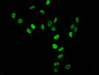 Immunofluorescent analysis of Hela cells using CAC13072 at dilution of 1:100 and Alexa Fluor 488-congugated AffiniPure Goat Anti-Rabbit IgG(H+L) Immunofluorescent analysis of Hela cells using CAC13072 at dilution of 1:100 and Alexa Fluor 488-congugated AffiniPure Goat Anti-Rabbit IgG(H+L)