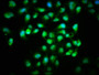 Immunofluorescence staining of Hela cells with CAC13079 at 1:166, counter-stained with DAPI. The cells were fixed in 4% formaldehyde, permeabilized using 0.2% Triton X-100 and blocked in 10% normal Goat Serum. The cells were then incubated with the antibody overnight at 4°C. The secondary antibody was Alexa Fluor 488-congugated AffiniPure Goat Anti-Rabbit IgG(H+L).
