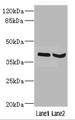 Western Blot, All lanes: HOXD10 antibody at 3.21ug/ml, Lane 1: Mouse liver tissue, Lane 2: Mouse gonadal tissue, Secondary, Goat polyclonal to rabbit IgG at 1/10000 dilution, Predicted band size: 38 kDa, Observed band size: 38 kDa Western Blot, All lanes: HOXD10 antibody at 3.21ug/ml, Lane 1: Mouse liver tissue, Lane 2: Mouse gonadal tissue, Secondary, Goat polyclonal to rabbit IgG at 1/10000 dilution, Predicted band size: 38 kDa, Observed band size: 38 kDa