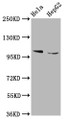 Western Blot, Positive WB detected in: Hela whole cell lysate, HepG2 whole cell lysate, All lanes: IKBKAP antibody at 5.3ug/ml, Secondary, Goat polyclonal to rabbit IgG at 1/50000 dilution, Predicted band size: 151 kDa, Observed band size: 151 kDa