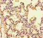 Immunohistochemistry of paraffin-embedded human lung tissue using CAC13088 at dilution of 1:100