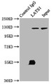 Immunoprecipitating LATS1 in K562 whole cell lysate , Lane 1: Rabbit control IgG (1ug) instead of CAC13098 in K562 whole cell lysate. For western blotting, a HRP-conjugated Protein G antibody was used as the secondary antibody (1/2000), Lane 2: CAC13098 (6ug) + K562 whole cell lysate (500ug), Lane 3: K562 whole cell lysate (10ug)
