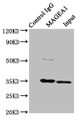 Immunoprecipitating MAGEA1 in Hela whole cell lysate, Lane 1: Rabbit control IgG instead of CAC13106 in Hela whole cell lysate. For western blotting, a HRP-conjugated Protein G antibody was used as the secondary antibody (1/2000), Lane 2: CAC13106 (8ug) + Hela whole cell lysate (500ug), Lane 3: Hela whole cell lysate (10ug) Immunoprecipitating MAGEA1 in Hela whole cell lysate, Lane 1: Rabbit control IgG instead of CAC13106 in Hela whole cell lysate. For western blotting, a HRP-conjugated Protein G antibody was used as the secondary antibody (1/2000), Lane 2: CAC13106 (8ug) + Hela whole cell lysate (500ug), Lane 3: Hela whole cell lysate (10ug)