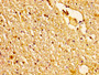IHC image of CAC13135 diluted at 1:200 and staining in paraffin-embedded human brain tissue performed on a Leica BondTM system. After dewaxing and hydration, antigen retrieval was mediated by high pressure in a citrate buffer (pH 6.0). Section was blocked with 10% normal goat serum 30min at RT. Then primary antibody (1% BSA) was incubated at 4°C overnight. The primary is detected by a biotinylated secondary antibody and visualized using an HRP conjugated SP system. IHC image of CAC13135 diluted at 1:200 and staining in paraffin-embedded human brain tissue performed on a Leica BondTM system. After dewaxing and hydration, antigen retrieval was mediated by high pressure in a citrate buffer (pH 6.0). Section was blocked with 10% normal goat serum 30min at RT. Then primary antibody (1% BSA) was incubated at 4°C overnight. The primary is detected by a biotinylated secondary antibody and visualized using an HRP conjugated SP system.