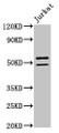 Western Blot, Positive WB detected in: Jurkat whole cell lysate, All lanes: NOVA1 antibody at 2ug/ml, Secondary, Goat polyclonal to rabbit IgG at 1/50000 dilution, Predicted band size: 53, 20, 50, 52 kDa, Observed band size: 53, 50 kDa Western Blot, Positive WB detected in: Jurkat whole cell lysate, All lanes: NOVA1 antibody at 2ug/ml, Secondary, Goat polyclonal to rabbit IgG at 1/50000 dilution, Predicted band size: 53, 20, 50, 52 kDa, Observed band size: 53, 50 kDa