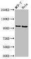 Western Blot, Positive WB detected in: MCF-7 whole cell lysate, Hela whole cell lysate, All lanes: NUP98 antibody at 3.2ug/ml, Secondary, Goat polyclonal to rabbit IgG at 1/50000 dilution, Predicted band size: 198, 188, 98, 97, 196, 187 kDa, Observed band size: 105 kDa Western Blot, Positive WB detected in: MCF-7 whole cell lysate, Hela whole cell lysate, All lanes: NUP98 antibody at 3.2ug/ml, Secondary, Goat polyclonal to rabbit IgG at 1/50000 dilution, Predicted band size: 198, 188, 98, 97, 196, 187 kDa, Observed band size: 105 kDa