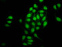 Immunofluorescence staining of A549 cells with CAC13141 at 1:100, counter-stained with DAPI. The cells were fixed in 4% formaldehyde, permeabilized using 0.2% Triton X-100 and blocked in 10% normal Goat Serum. The cells were then incubated with the antibody overnight at 4°C. The secondary antibody was Alexa Fluor 488-congugated AffiniPure Goat Anti-Rabbit IgG(H+L). Immunofluorescence staining of A549 cells with CAC13141 at 1:100, counter-stained with DAPI. The cells were fixed in 4% formaldehyde, permeabilized using 0.2% Triton X-100 and blocked in 10% normal Goat Serum. The cells were then incubated with the antibody overnight at 4°C. The secondary antibody was Alexa Fluor 488-congugated AffiniPure Goat Anti-Rabbit IgG(H+L).