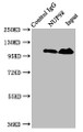 Immunoprecipitating NUP98 in Jurkat whole cell lysate, Lane 1: Rabbit control IgG instead of CAC13141 in Jurkat whole cell lysate., For western blotting, a HRP-conjugated Protein G antibody was used as the secondary antibody (1/2000), Lane 2: CAC13141 (8ug) + Jurkat whole cell lysate (500ug), Lane 3: Jurkat whole cell lysate (20ug) Immunoprecipitating NUP98 in Jurkat whole cell lysate, Lane 1: Rabbit control IgG instead of CAC13141 in Jurkat whole cell lysate., For western blotting, a HRP-conjugated Protein G antibody was used as the secondary antibody (1/2000), Lane 2: CAC13141 (8ug) + Jurkat whole cell lysate (500ug), Lane 3: Jurkat whole cell lysate (20ug)