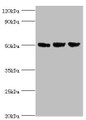 Western Blot, All lanes: ORC4 antibody at 4ug/ml, Lane 1: Hela whole cell lysate, Lane 2: Jurkat whole cell lysate, Lane 3: A549 whole cell lysate, Secondary, Goat polyclonal to rabbit IgG at 1/10000 dilution, Predicted band size: 51, 41, 43 kDa, Observed band size: 51 kDa Western Blot, All lanes: ORC4 antibody at 4ug/ml, Lane 1: Hela whole cell lysate, Lane 2: Jurkat whole cell lysate, Lane 3: A549 whole cell lysate, Secondary, Goat polyclonal to rabbit IgG at 1/10000 dilution, Predicted band size: 51, 41, 43 kDa, Observed band size: 51 kDa