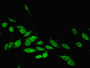 Immunofluorescent analysis of Hela cells using CAC13149 at dilution of 1:100 and Alexa Fluor 488-congugated AffiniPure Goat Anti-Rabbit IgG(H+L) Immunofluorescent analysis of Hela cells using CAC13149 at dilution of 1:100 and Alexa Fluor 488-congugated AffiniPure Goat Anti-Rabbit IgG(H+L)