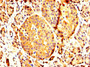 IHC image of CAC13150 diluted at 1:200 and staining in paraffin-embedded human pancreatic tissue performed on a Leica BondTM system. After dewaxing and hydration, antigen retrieval was mediated by high pressure in a citrate buffer (pH 6.0). Section was blocked with 10% normal goat serum 30min at RT. Then primary antibody (1% BSA) was incubated at 4°C overnight. The primary is detected by a biotinylated secondary antibody and visualized using an HRP conjugated SP system. IHC image of CAC13150 diluted at 1:200 and staining in paraffin-embedded human pancreatic tissue performed on a Leica BondTM system. After dewaxing and hydration, antigen retrieval was mediated by high pressure in a citrate buffer (pH 6.0). Section was blocked with 10% normal goat serum 30min at RT. Then primary antibody (1% BSA) was incubated at 4°C overnight. The primary is detected by a biotinylated secondary antibody and visualized using an HRP conjugated SP system.