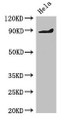 Western Blot, Positive WB detected in: Hela whole cell lysate, All lanes: PDE2A antibody at 2ug/ml, Secondary, Goat polyclonal to rabbit IgG at 1/50000 dilution, Predicted band size: 106, 104, 105, 79, 88 kDa, Observed band size: 88 kDa Western Blot, Positive WB detected in: Hela whole cell lysate, All lanes: PDE2A antibody at 2ug/ml, Secondary, Goat polyclonal to rabbit IgG at 1/50000 dilution, Predicted band size: 106, 104, 105, 79, 88 kDa, Observed band size: 88 kDa